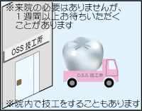 4.技工所で装着物を制作します