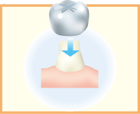 5.装着します