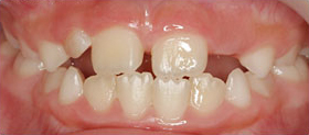Before