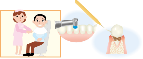 歯周病の治療方法は？
