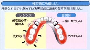 4.他の健康な歯に過度な負担を掛けない