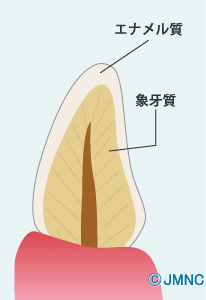 エナメル質 象牙質②