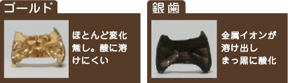 コールド ほとんど変化無し。酸に溶けにくい 銀歯 金属イオンが溶け出しまっ黒に酸化