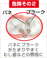 危険その2 バネ プラーク バネにプラークがたまりやすくむし歯などの原因に